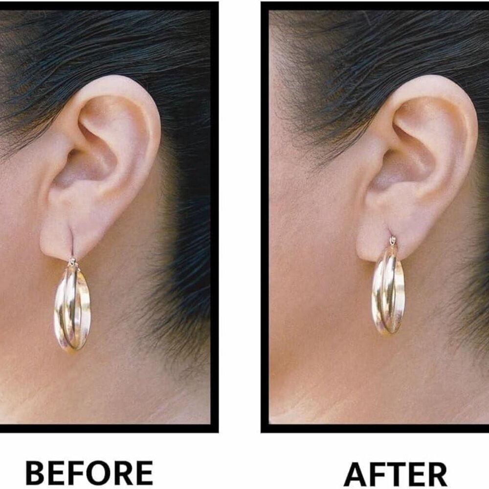 The ORIGINAL Ear Lobe Support Patch for Pierced Ears - Eliminates the Look of To - Picture 2 of 6